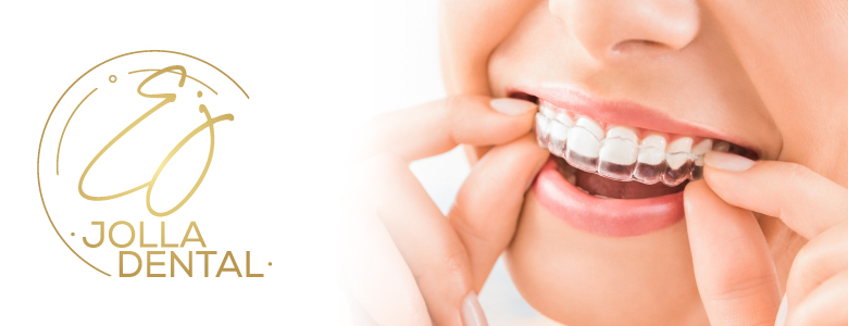 Invisalign ‎‎‏‏‎ ‎‏‏‎ ‎‏‏‎ ‎‏‏‎ ‎‏‏‎ ‎‏‏‎ ‎‏‏ ‎‏‏‎