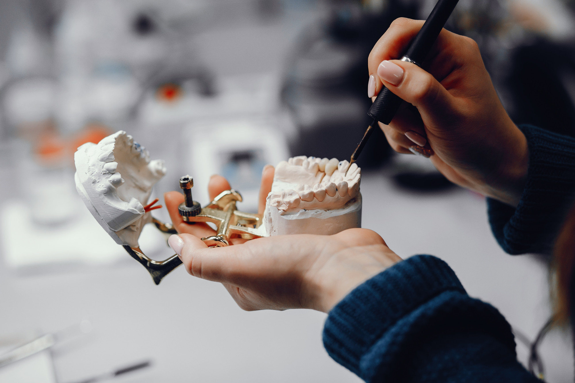 Jolla Dental Tirana Albania - Modelim Dhembesh